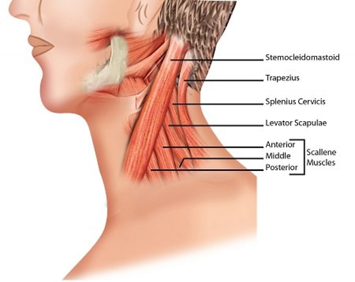 cervical dystonia pain
